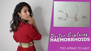 Too Afraid to Ask About Hemorrhoids  Doctor Explains Causes Symptoms and Treatment 👩‍⚕️ [upl. by Sully810]