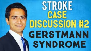 GERSTMANN SYNDROME STROKE CASE PRESENTATION STROKE CASE SCENARIO DISCUSSIONUSMLE [upl. by Annalise538]