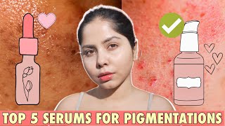 Best Serum To Reduce Dark Spots Pigmentation Ponds Bright Beauty Anti Pigmentation Serum [upl. by Araiet]