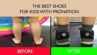 The Best Shoes for Kids with Pronation  Lets Improve Your Childs Posture [upl. by Lindon]