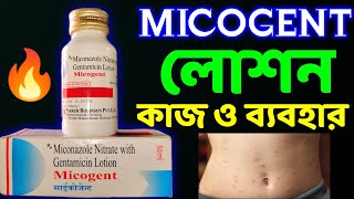 Micogent Lotion Uses In Bengali  Miconazole Lotion [upl. by Nonad]