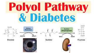 Polyol Pathway amp Diabetes  The Role of Polyol Pathway in Diabetes Pathogenesis [upl. by Shay]