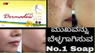 Dermadew Liite Soap Review In KannadaSkin whiteningRemove PigmentationGlowing skin [upl. by Natale]