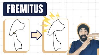 Fremitus and Occlusal Overload  Dental Occlusion Geekiness  PDP160 [upl. by Grani]