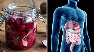 How To Make Beet Kvass  A Cleansing Medicinal Tonic [upl. by Baerl]