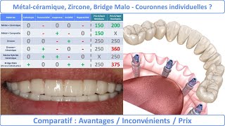 Quel matériau pour refaire ses dents  Comment choisir son bridge sur implants [upl. by Enelram704]