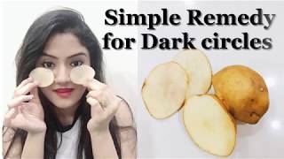 100 Natural and Effective home remedy for dark circles  In Hindi [upl. by Glick]