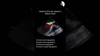 Echocardiography board practice question 13 [upl. by Zednanreh]