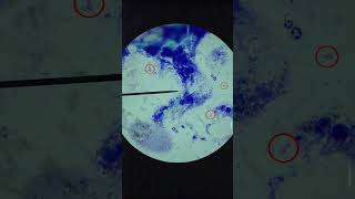 How To Read An Ear Cytology shorts veterinarymedicine [upl. by Salohcin169]