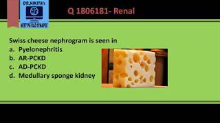 IVP in Polycystic kidney disease  Nephrogram appearance [upl. by Ewolram721]