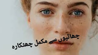 Freckle treatmentpigmentation permanent curechayun is ilaj [upl. by Romy]