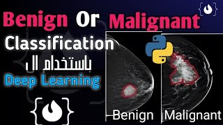 Benign Or Malignant  Classification projects using Deep learning تصنيف الخلايا الحميده والسرطانيه [upl. by Templeton]