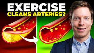 This Exercise Clears Plaque in Your Arteries New Trial [upl. by Ninon133]