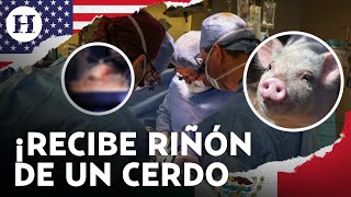 ¡Histórico trasplante Colocan exitosamente riñón de cerdo modificado en un humano por primera vez [upl. by Suzanne]