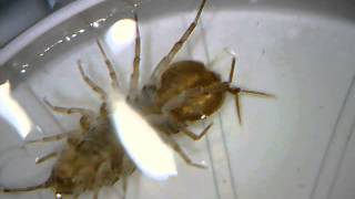 microscope video of asellus aquaticus waterlouse aquatic sowbug  Wasserassel unterm Mikroskop [upl. by Aleak]