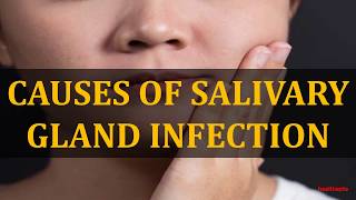 CAUSES OF SALIVARY GLAND INFECTION [upl. by Riedel]