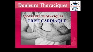 Reconnaitre une crise cardiaque des autres douleurs thoraciques symptomes [upl. by Ariek535]