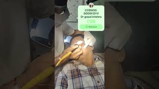 Skin tags on the face and neck removal with RF by Dr gopal krishna MD COSMOS vizag AND hyderabad [upl. by Evad]