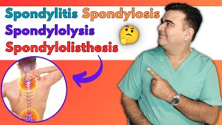 Discover the Key Differences Spondylitis vs Spondylosis vs Spondylolysis vs Spondylolisthesis [upl. by Loveridge]