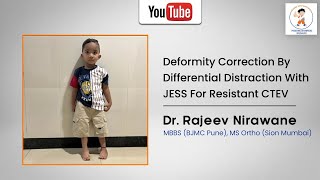 Deformity correction by differential distraction with JESS for resistant CTEV Done by Dr Nirawane [upl. by Eardna]