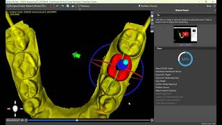 Designing Your First Surgical Guide in Blue Sky Plan Wizard  Version 41331 Updated [upl. by Chong]