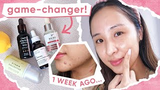 4 BEST BRIGHTENING SERUMS vitamin c acne amp hyperpigmentation [upl. by Riamu]