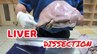 Anatomy Dissection of Liver [upl. by Odama]