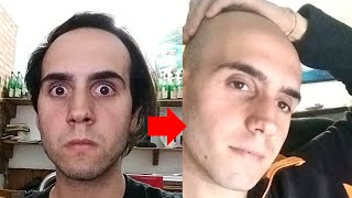 Balding Man More Attractive After Shaving Head Bald [upl. by Nylesoy877]