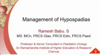 Hypospadias Management Lecture by Dr Ramesh Babu [upl. by Rockefeller]