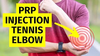 PRP Injection for Elbow Pain  Tennis and Golfers Elbow Treatment [upl. by Calan]