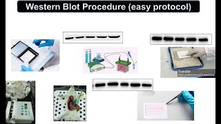 Western Blot Procedure easy protocol [upl. by Adeys]