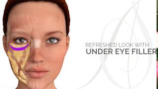 Having a Refreshed Look With Under Eye Filler [upl. by Ayekel]