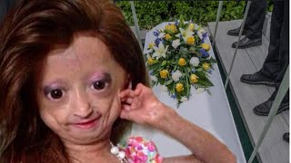 RIP Youtuber Adalia Rose Died Last Moment With her Mother😭This is so sd [upl. by Netsrejk]