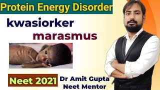 kwashiorkor and marasmus disease in hindi  protein energy malnutrition disorder  neet 2025 biology [upl. by Epilef317]