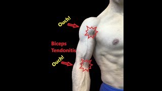 Biceps Tendonitis  Exercises And Myofascial Release [upl. by Hyacinthe]