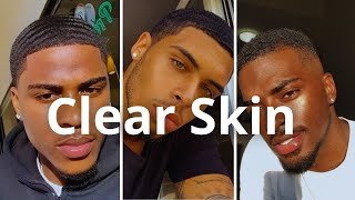 How To Get Clear Skin Naturally [upl. by Jeremy829]