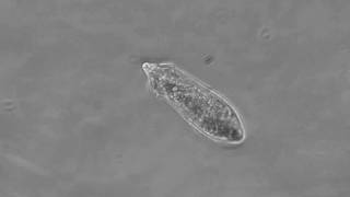 Schistosoma Mansoni Miracidium Swimming [upl. by Ahsikyw]