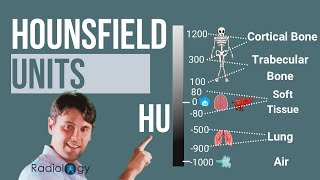 Hounsfield Units Where do CT numbers come from [upl. by Himelman]