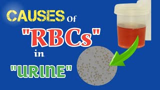 Causes of RBCs in Urine  Clinical Importance Hematuria Symptoms False hematuria  Animated [upl. by Brey]