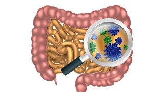 6 Steps to Heal Leaky Gut and Autoimmune Disease Naturally [upl. by Wiggins]