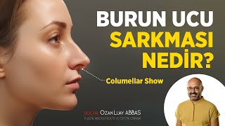 Burun Ucu Sarkması Columellar Show Nedir  Doç Dr Ozan Luay Abbas [upl. by Belldame]