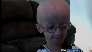 Kaylees race for Progeria [upl. by Gibbie]