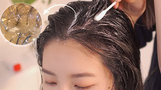 ASMR 시원한 두피 마사지스케일링빗질  Scalp Massage and Scalp Scaling [upl. by Eigger469]