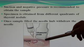 Fine Needle Aspiration Cytology by Dr Danish [upl. by Adriell987]