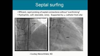 Retrograde StepbyStep  Farouc Jaffer MD PhD [upl. by Batish750]