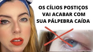 COMO CORRIGIR PTOSE SEM CIRURGIA😱ESSA DICA É INCRÍVELptosepalpebral cirurgiadaspalpebras [upl. by Ainimreh]