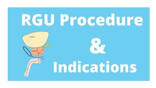 RGU procedure amp its indication [upl. by Nata]