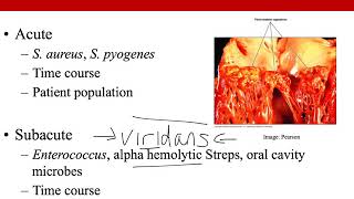 Infective Endocarditis [upl. by Nyahs]