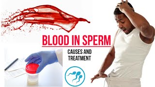 Blood in Sperm  HEMATOSPERMIA  Causes And Treatment [upl. by Meador]