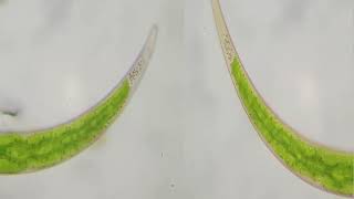 Closterium  Dance of the Gypsum Crytals [upl. by Gomez]